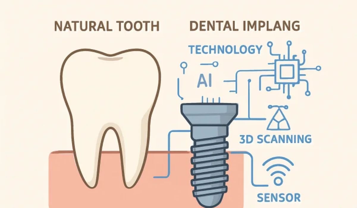 Future of Dental Implants
