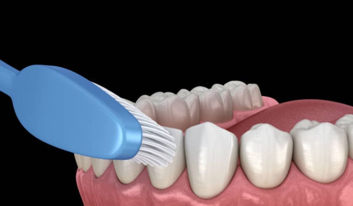 Regular Dental Cleanings