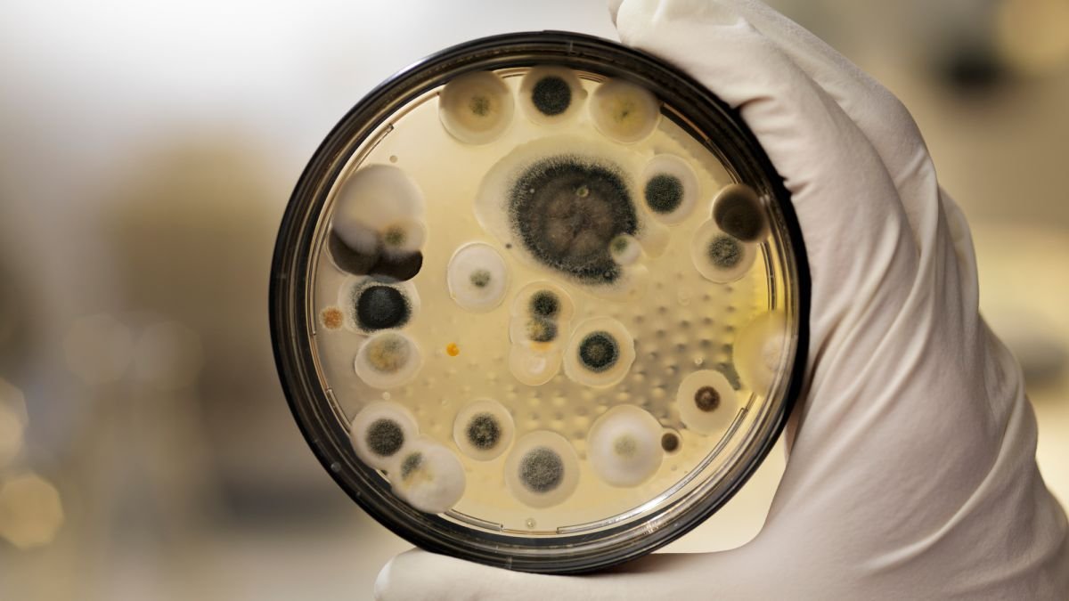 Mold Toxicity Test
